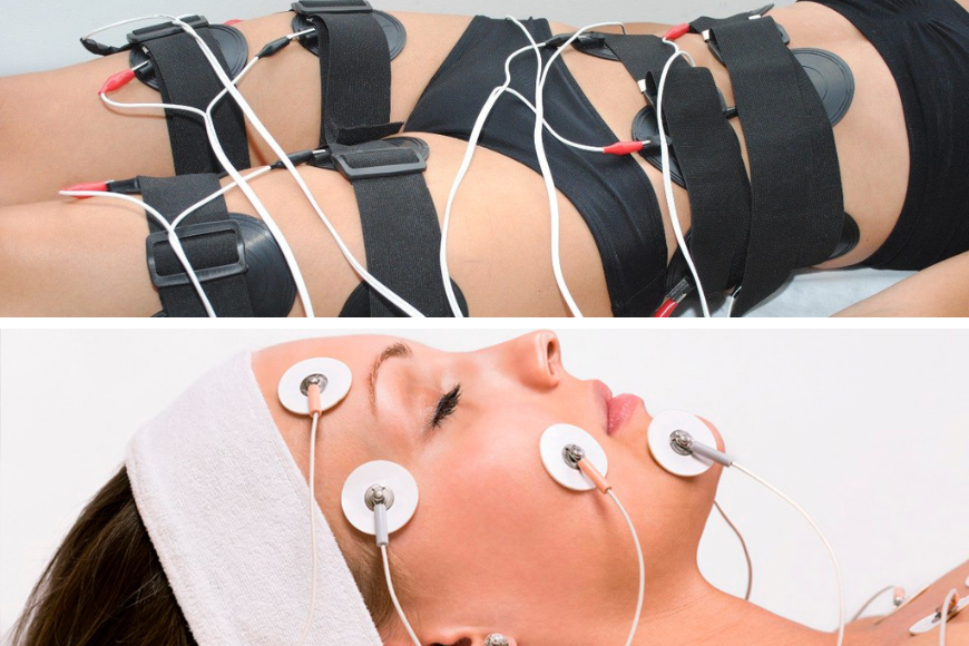 EMS: qué es, cómo funciona y para qué sirve la electroestimulación muscular