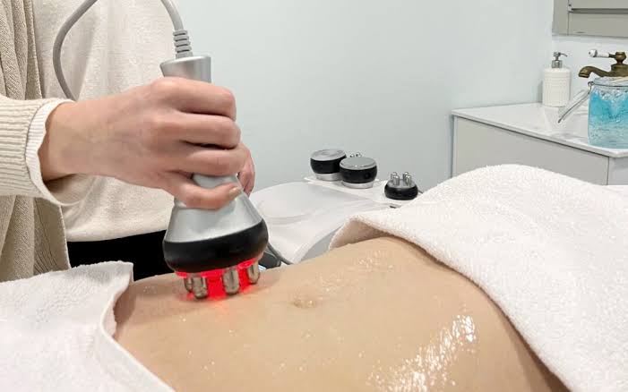 ¿Qué Radiofrecuencia Comprar? Guía Completa para Elegir la Ideal